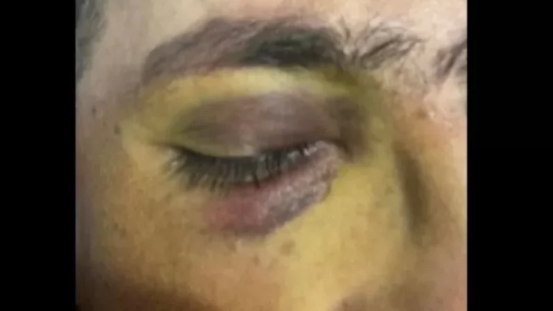 Դիվիզիոնի շտաբի պետը դաժան ծեծի՞ է ենթարկել իր ենթակային․ Shamshyan