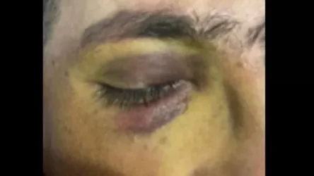 Դիվիզիոնի շտաբի պետը դաժան ծեծի՞ է ենթարկել իր ենթակային․ Shamshyan