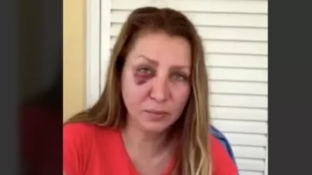 Ուկրաինացիների 30 հոգանոց խումբը Հունաստանում դաժան ծեծի է ենթարկել 4 ռուսի. մանրամասներ