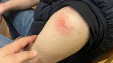 Կարմիր բերետավորները բերման ենթարկելիս վնասվածքներ են հասցրել հադրութեցի անչափահաս տղային․ փաստաբան