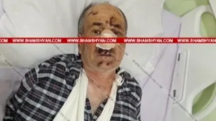 Լուսանկար․ Արտակարգ դեպք Վայոց Ձորի մարզում. արջը հարձակվել է բոխի հավաքող տղամարդու վրա