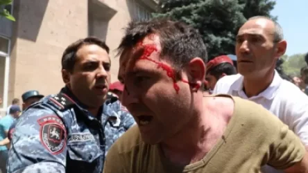 ԼՈՒՍԱՆԿԱՐՆԵՐ. «Սա է Նիկոլի դեմքը». Սաղաթելյան