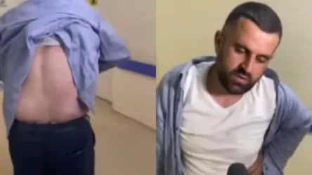 ՏԵՍԱՆՅՈՒԹ. Կողամատերի կոտրվածք. քաղաքացին ոստիկանների կողմից ծեծի ենթարկվելու մասին