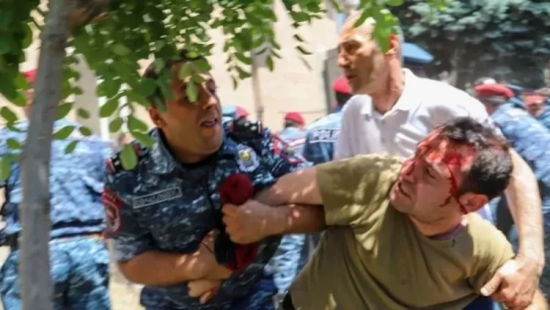 Ոստիկանական վայրագությունների մասին  կտեղեկացվեն նաև մեր միջազգային գործընկերները. Թովմասյան