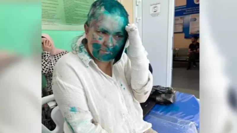 PHOTO: New Image of Journalist Assaulted in Chechnya