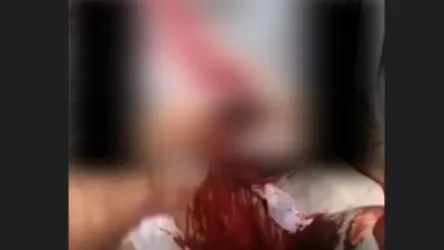 Տղան մոտեցել էր ծխախոտ խնդրելու․ մանրամասներ՝ ռուս տղայի գլխամաշկը «մազերի պատճառով» հանելու դեպքից