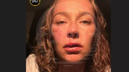 ԼՈՒՍԱՆԿԱՐՆԵՐ․ Ծեծ՝ քաղաքական հարցերի պատճառով․ տուժողը ռուս հայտնի հաղորդավարուհի է