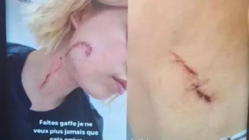 PHOTOS: 19-Year-Old Girl Attacked by Arab Gang in France Due to 'Revealing Clothing'