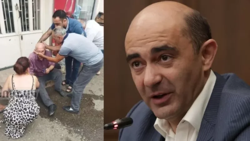 PHOTO: People in Artsakh Lose Consciousness Daily Due to Malnutrition, Marukyan