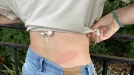 ՏԵՍԱՆՅՈՒԹ. Ադրբեջանցիները Նյու Յորքում հարձակվել են հայ ընտանիքի վրա, հարվածել երիտասարդ աղջկան