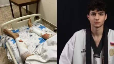 Իգոր Կարապետյանը՝ լուսաձայնային նռնակից վնասվածք ստանալու մասին