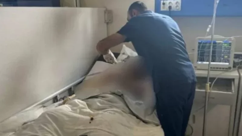 «Մեծ մասի առողջական վիճակը գնահատվում է ծայրահեղ ծանր և ծանր»․ Ավանեսյանը նշել է՝ քանի տուժած կա Երևանի այրվածքաբանության կենտրոնում