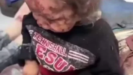 ՏԵՍԱՆՅՈՒԹ. Գազայի հիվանդանոցում ավիահարվածի զոհերի թիվը հասել է 800-ի. Al Arabiya