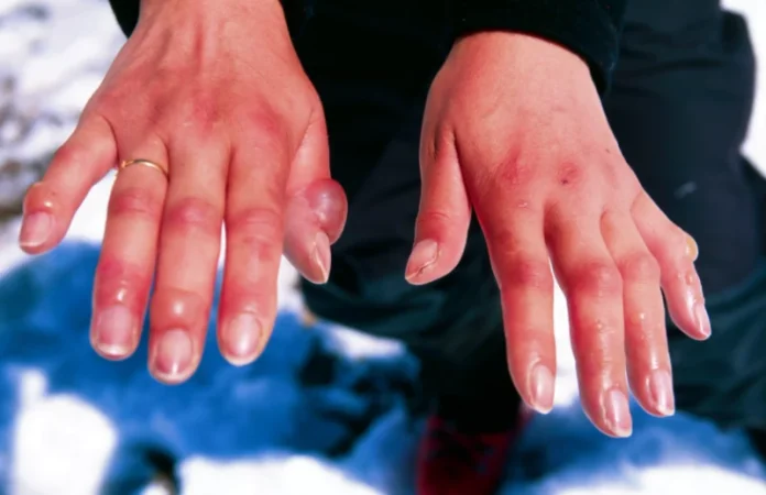 Եկատերինբուրգում ցրտահարված մորն ու նրա երեխային հայտնաբերել են շքամուտքի մոտ