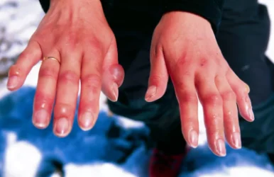 Եկատերինբուրգում ցրտահարված մորն ու նրա երեխային հայտնաբերել են շքամուտքի մոտ