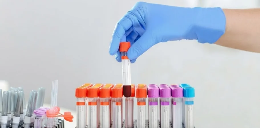 Մշակվել է թեստ․ մեկ կաթիլ արյունը թույլ է տալիս ախտորոշել քաղցկեղը