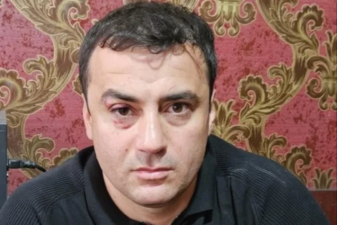 Արթուր Չախոյանը հիվանդանոցից դուրս է գրվել