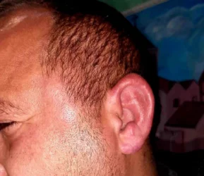 ԼՈՒՍԱՆԿԱՐՆԵՐ․ Քաղաքացին Բավրայի մաքսատան աշխատակիցների կողմից դաժան ծեծի է ենթարկվել. իրավապաշտպան