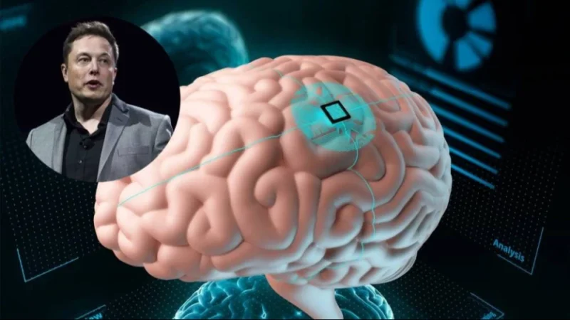 Մասկի ընկերությունը մարդու ուղեղում իմպլանտ է տեղադրել