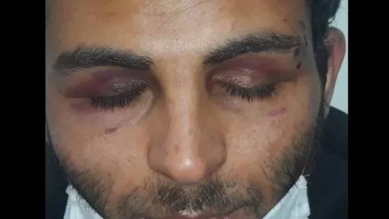 Արման Սարգսյանը հանձնարարել է ստուգել քաղաքացուն խոշտանգելու ահազանգի մանրամասները. ՄԻՊ