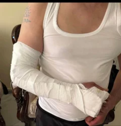 Կոտրել են ձեռքը, վնասել ականջը. Մասիսի ոստիկանության բաժնում քաղաքացիների են խոշտանգել