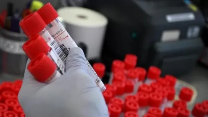 Հաստատվել է կորոնավիրուսի վարակման 2383 դեպք