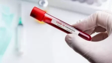 Հայաստանում հաստատվել է կորոնավիրուսով վարակվելու 422 նոր դեպք