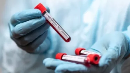 Կորոնավիրուսային հիվանդության ընթացքը Հայաստանում. 453 նոր դեպք