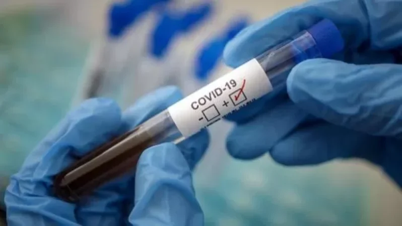 Կորոնավիրուսով վարակման 715 նոր դեպք մեկ օրում