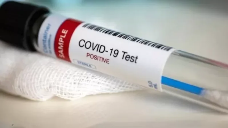 Տոնական օրերին կորոնավիրուսի նմուշառման գործընթացը շարունակվելու է. ԱՆ