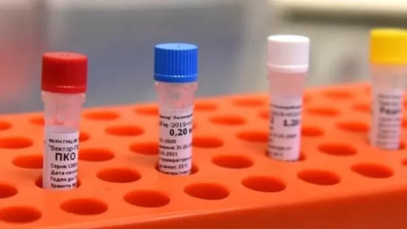 Հայաստանում մեկ օրում հաստատվել է կորոնավիրուսի 114 դեպք նոր դեպք