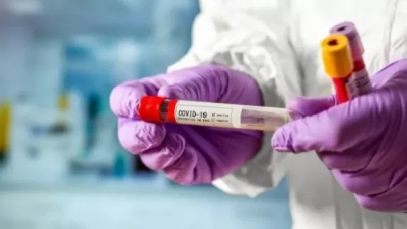 Հայաստանում հաստատվել է կորոնավիրուսով վարակվելու 764 նոր դեպք