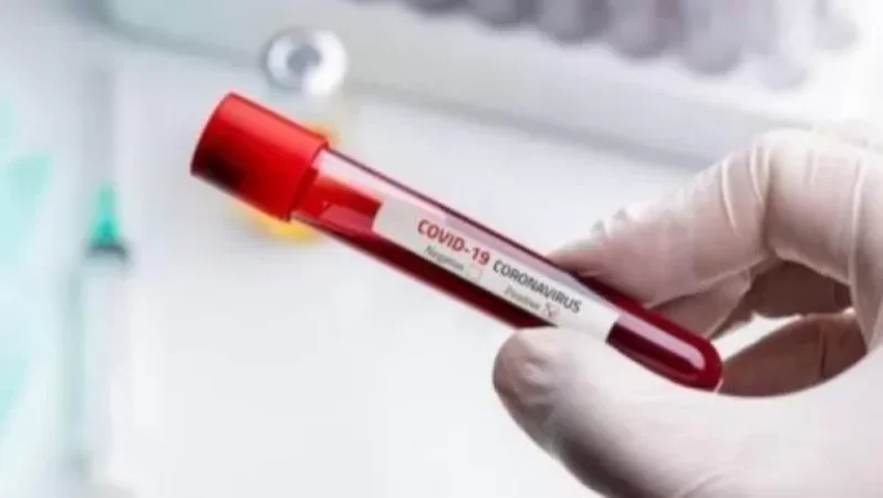 Հայաստանում օգոստոսի 10-ի դրությամբ կորոնավիրուսի 23 նոր դեպք է հաստատվել