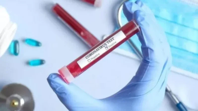 ՌԴ-ում մեկ օրում արձանագրվել է կորոնավիրուսով վարակման նոր ռեկորդ