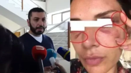 ՏԵՍԱՆՅՈՒԹ.  Բաքոյանը` կնոջը ծեծի ենթարկելու մասին