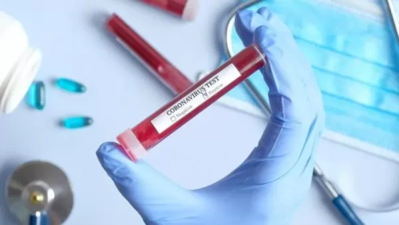 Հայաստանում հաստատվել է կորոնավիրուսով վարակվելու 277. մեկ օրում առողջացածների թիվը 57 է