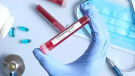 Հայաստանում հաստատվել է կորոնավիրուսով վարակվելու 277. մեկ օրում առողջացածների թիվը 57 է