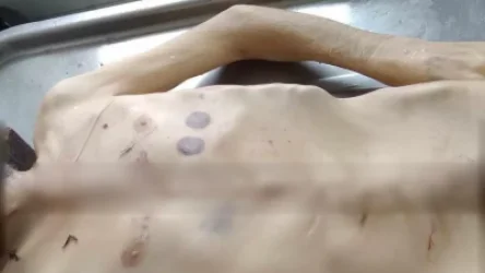 ԼՈՒՍԱՆԿԱՐՆԵՐ. Արցախում սովամահության դեպք է արձանագրվել. ՄԻՊ