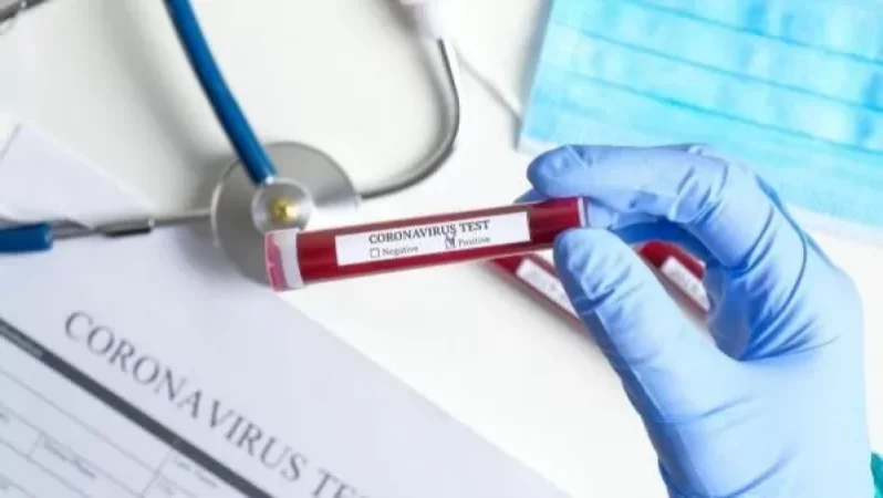 Հայաստանում կորոնավիրուսով վարակվածների թիվն ավելացել է 209-ով