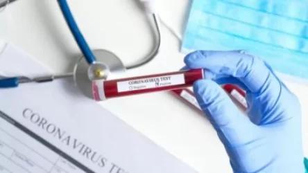 Հայաստանում կորոնավիրուսով վարակվածների թիվն ավելացել է 209-ով