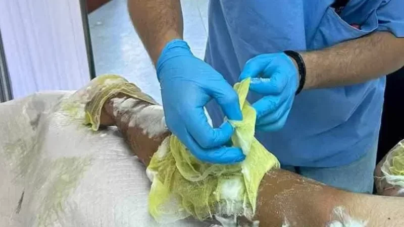 Photos: Condition of Man Injured in Gas Station Explosion is Assessed as Stable