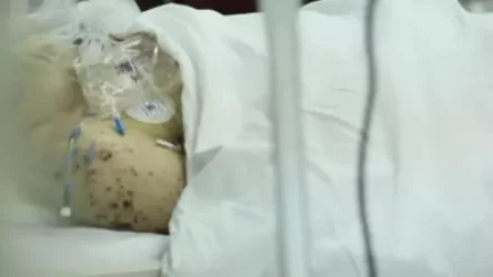 ՏԵՍԱՆՅՈՒԹ. «Ունեցել եմ վիրավոր, որ ի վիճակի չէր հետ գնալու,բայց ասում էր` շուտ արեք, ես գնամ». պատմում է բժիշկը