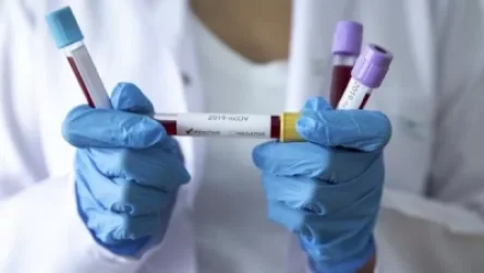 491 նոր դեպք, 218 առողջացած. կա 4 մահ․ կորոնավիրուսի տվյալները