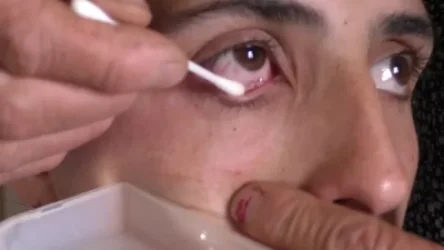 ՏԵՍԱՆՅՈՒԹ․ Հայ կնոջ աչքերից բյուրեղներ է թափվում