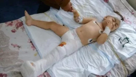 Մարտունիում ռմբակոծությունից վիրավորված 2-ամյա Արծվիկը  վիրահատվել է