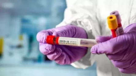 Հայաստանում կորոնավիրուսով վարակվելու որքան նոր դեպք է արձանագրվել. ԱՆ հրապարակել է տվյալները