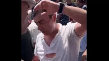 «Նրանք մեզ չեն քաշքշել, կոնկրետ խփել են... հստակ հանձնարարություն են ստացել». Սաղաթելյանը նշեց տուժած պատգամավորների անունները