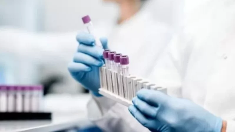 COVID-19-ի թեստավորման գինը կնվազի՝ դառնալով առավելագույնը 15 հազար դրամ