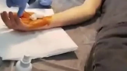 ՏԵՍԱՆՅՈՒԹ․ Երիտասարդը բերման ենթարկվելիս վնասվածք է ստացել. նա ԲԿ-ում է