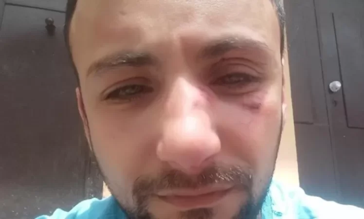 Վարդան Հարությունյանին ծեծի ենթարկելու դեպքով ևս մեկ քաղաքացի է ներկայացել ոստիկանություն. tert am